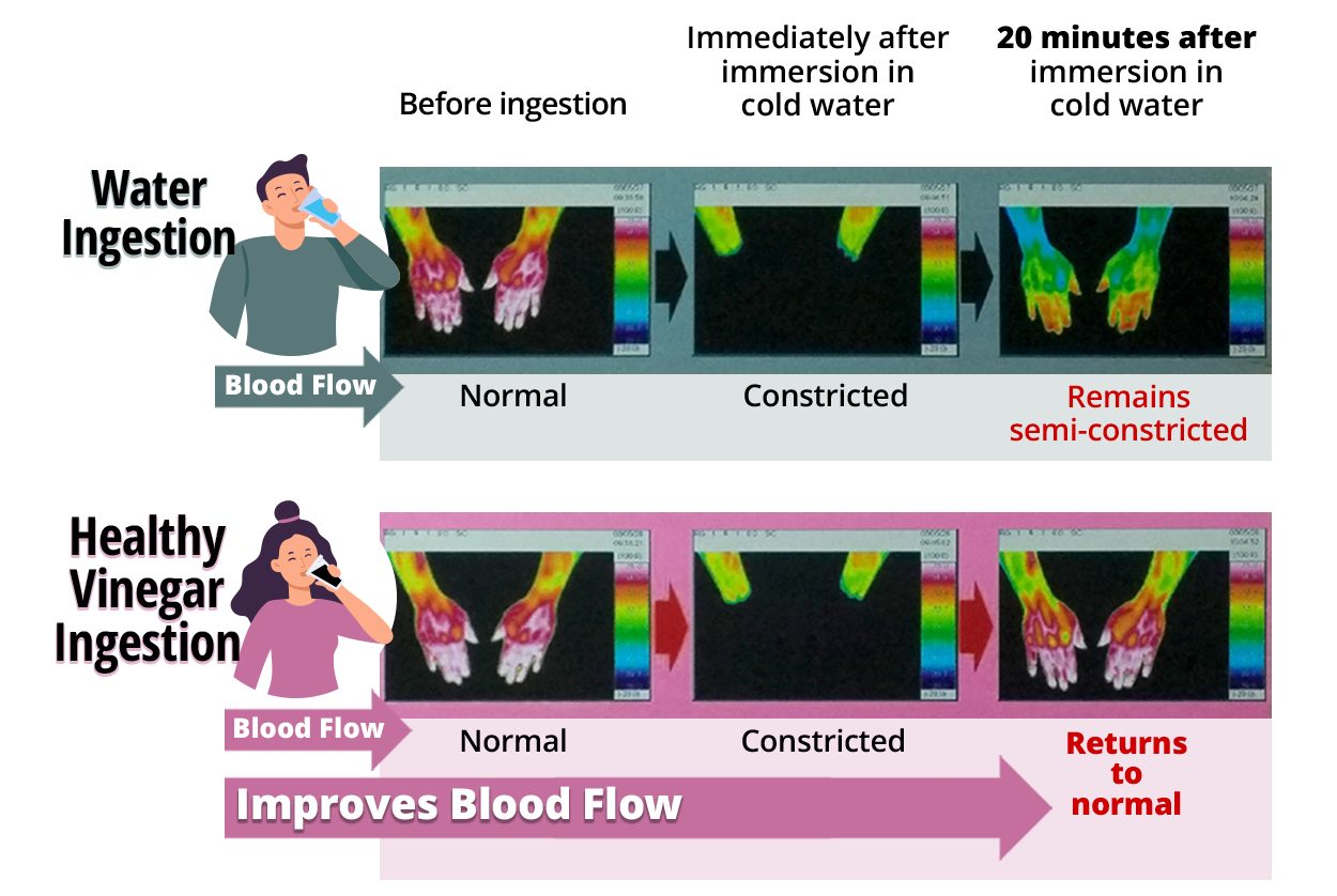 Blood Flow